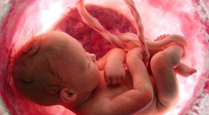 677px x 374px - Especialistas operaron en Colombia un feto en el vientre de la madre con  apenas 25 semanas â€“ Foco Informativo